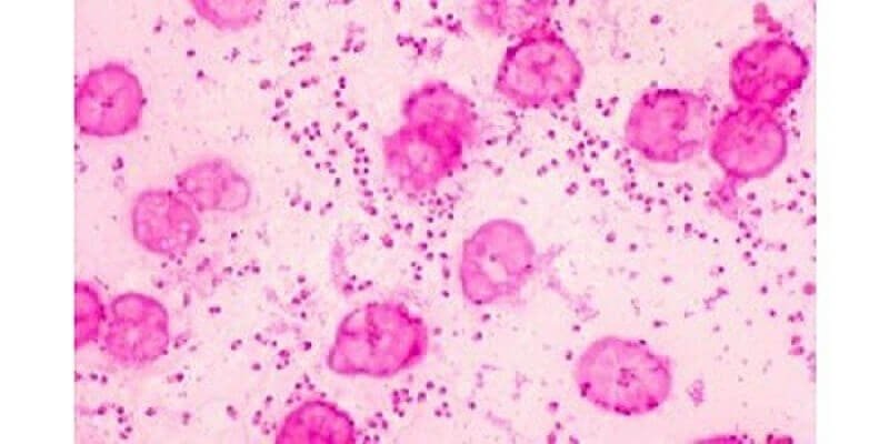 Bệnh tả chim là gì? Nó gây ra thiệt hại gì? - Tiến Thắng Vet